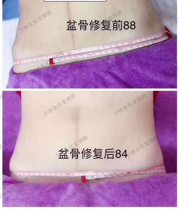   ���������îa(ch��n)���Ŀ-�����ޏ�(f��)