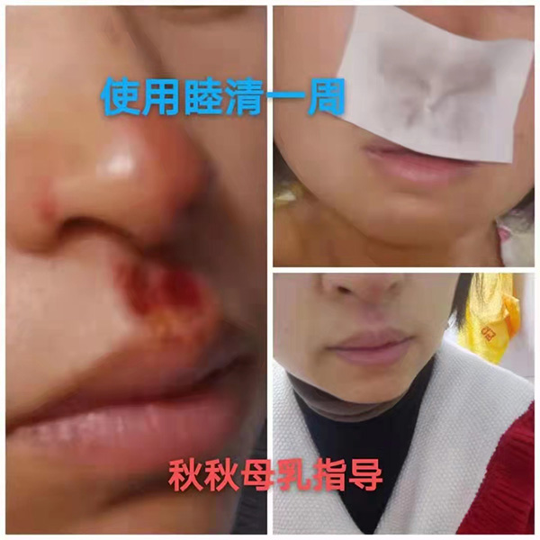 �����澏���N���Æ᣿���M(f��i)�߿ڱ���������(sh��)���a(ch��n)ƷȦ�۟o(w��)��(sh��)