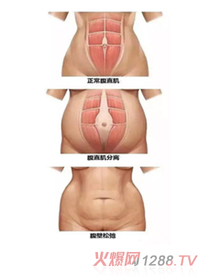 ���������îa(ch��n)���(xi��ng)Ŀ-��ֱ���ޏ�(f��)